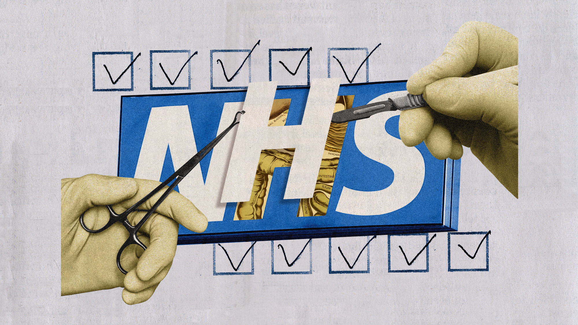 Photo collage of the NHS logo being operated on by giant hands. They&#039;re lifting off the letter H, revealing a diagram of human intestines inside