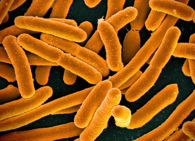 E. coli