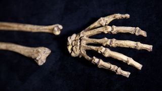 A photo of the hand bones of Australopithecus sediba