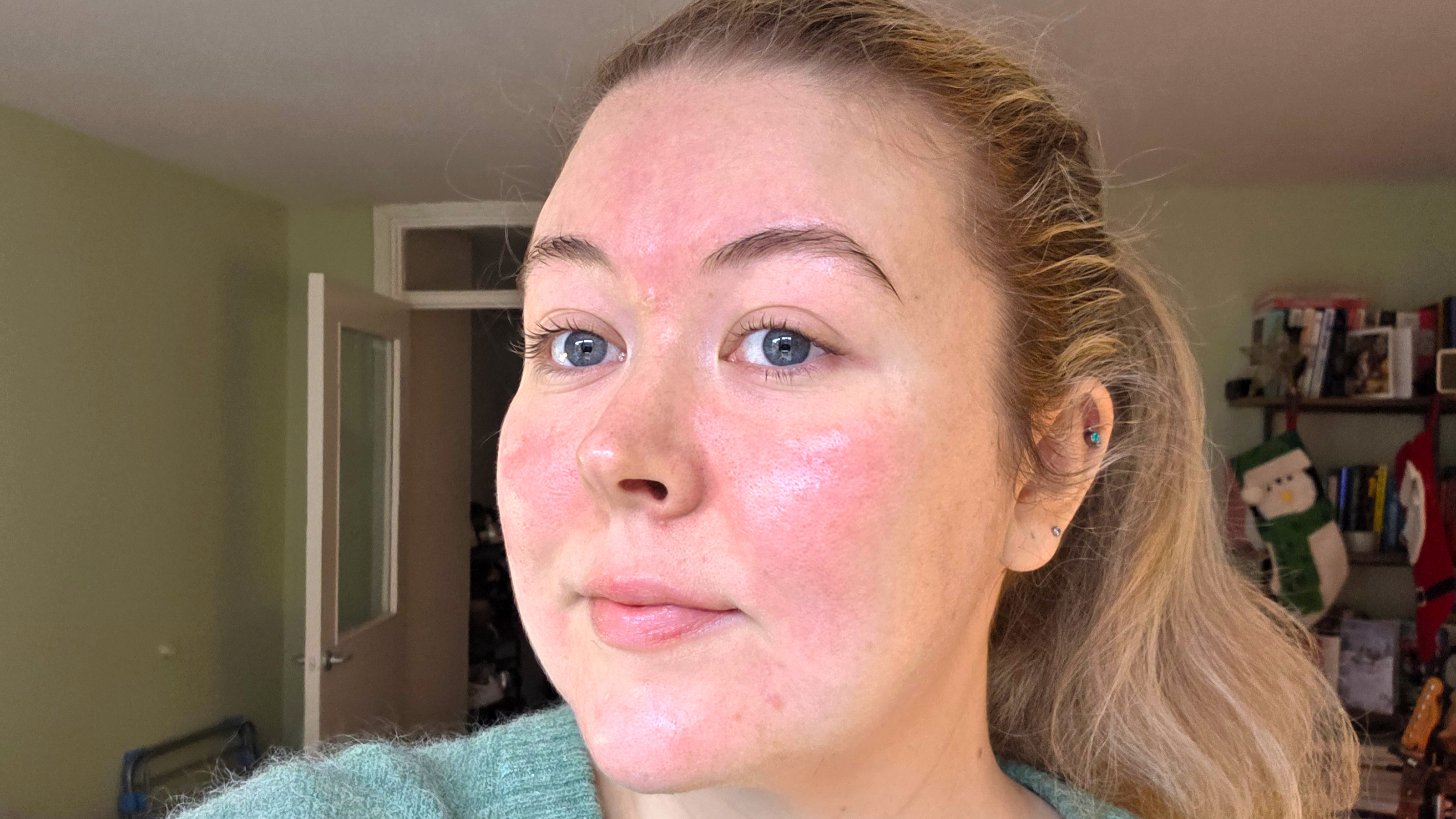 Shark FacialPro Glow