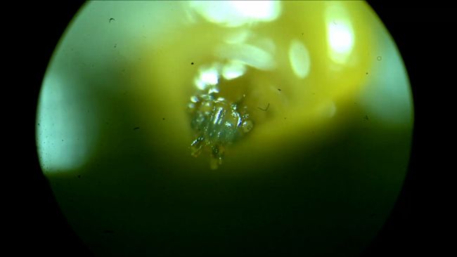 Thousands of Writhing Maggots Create the World's Creepiest Fountain ...