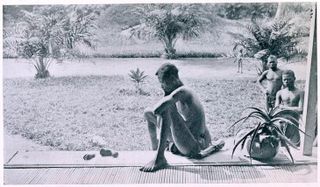Alice Seeley Harris' photo of a father looking at the severed hand and foot of his five-year-old daughter. Her photos helped to expose the abuses in the Congo