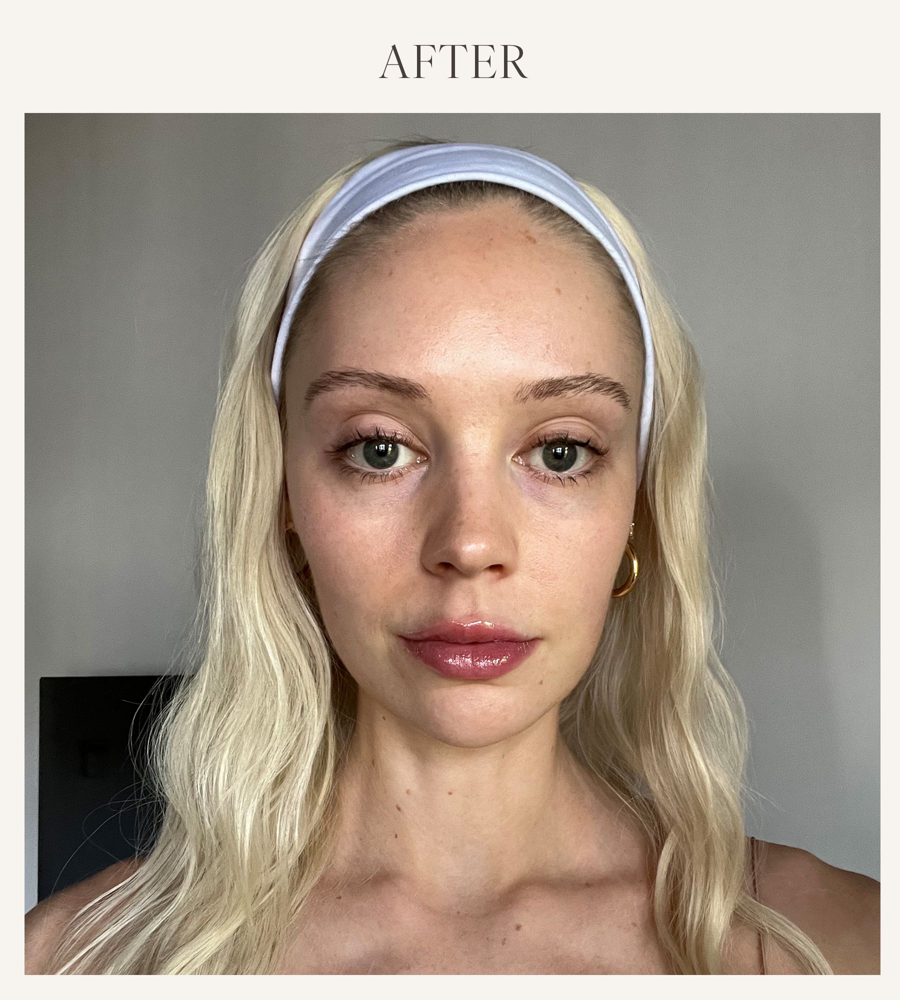 After photo of Erin Jahns testing the Grande Cosmetics lip plumper