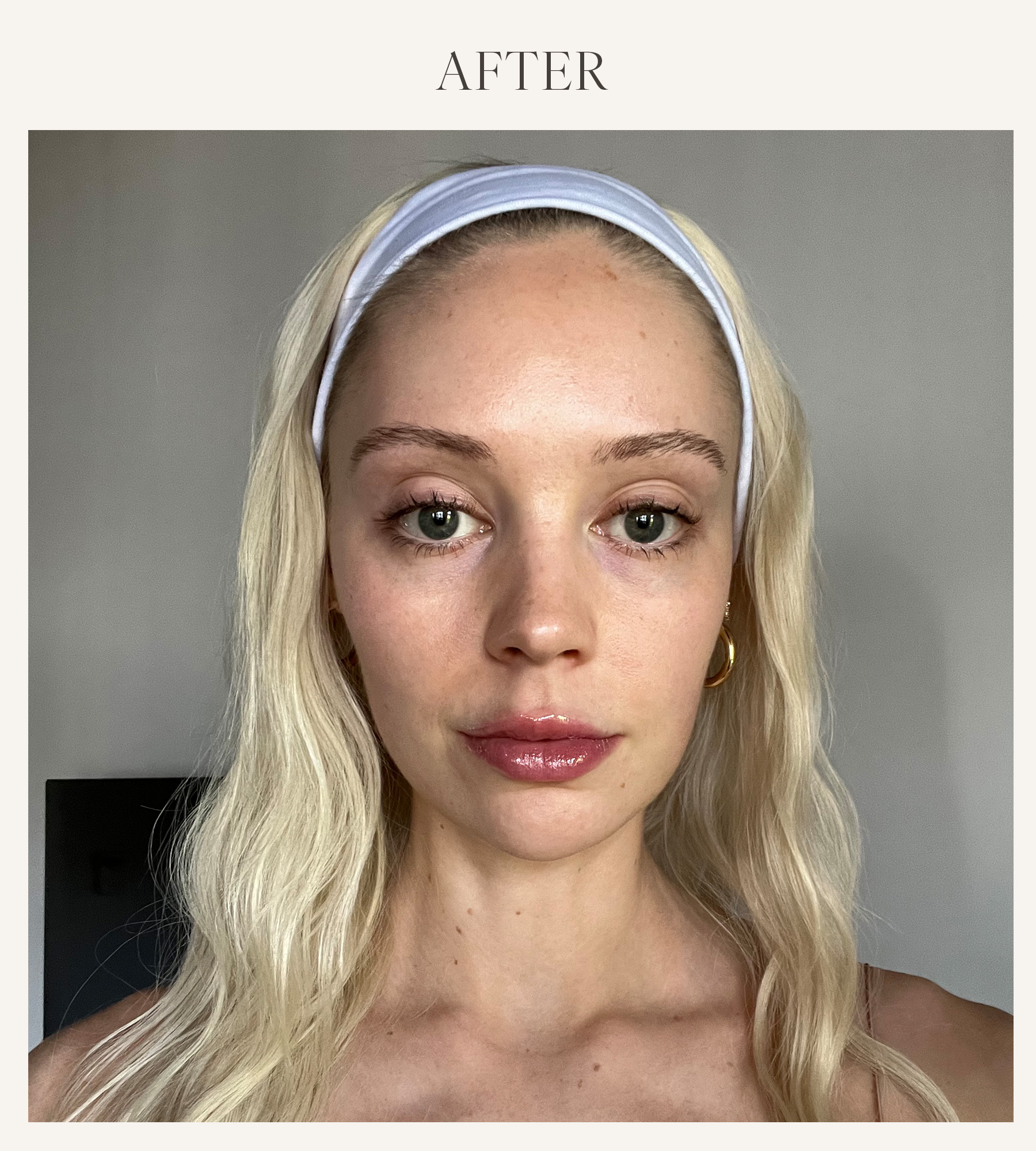 After photo of Erin Jahns testing the Grande Cosmetics lip plumper 