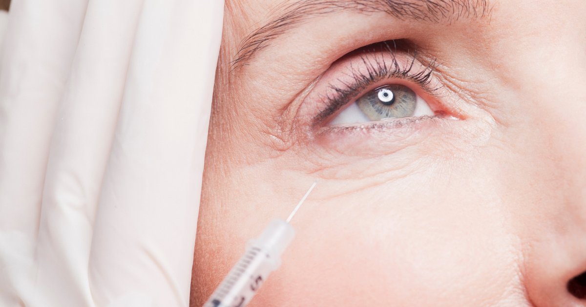 how perimenopause affects aesthetic treatments