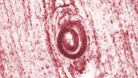 a pink and white micrograph depicts a curled, worm shape embedded in muscle tissue