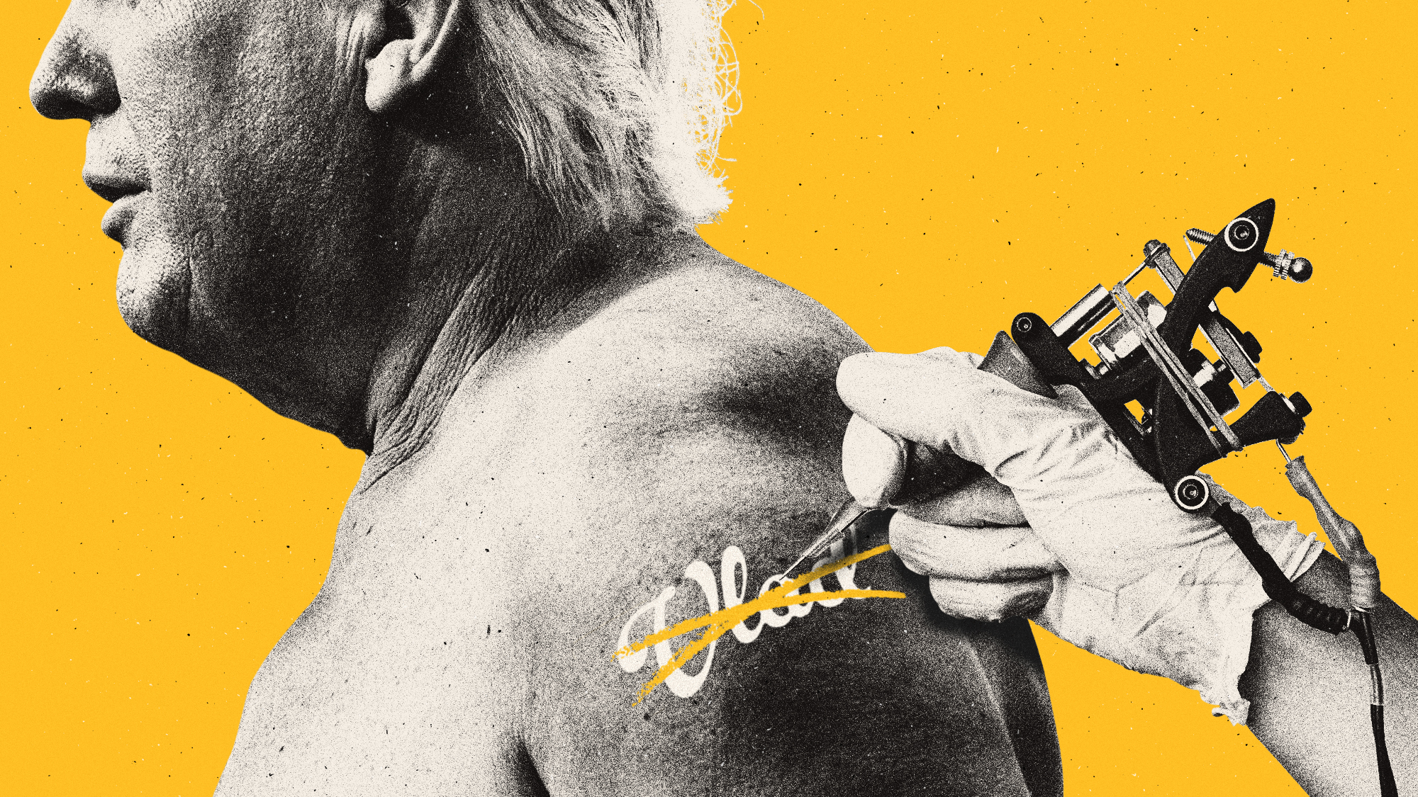 Photo composite of Donald Trump having a Vlad tattoo removed