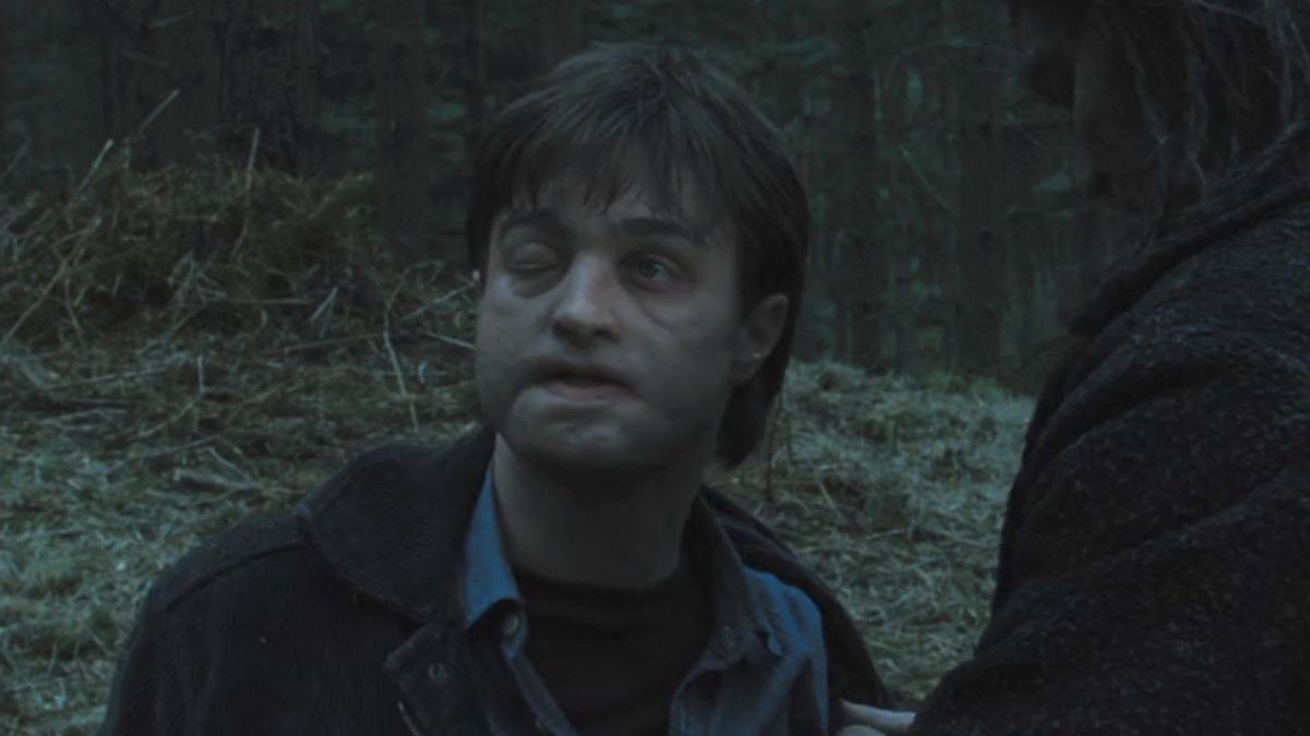 Harry with a messed up face in Deathly Hallows Part 1