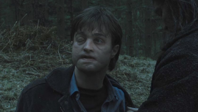 Harry with a messed up face in Deathly Hallows Part 1