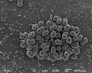 A bacterium that causes deadly cerebrospinal meningitis, Neisseria meningitidis, uses type IV pili to help it erode and cross the human blood brain barrier, a structure that surrounds the brain tissue and ordinarily protects it from invasion.