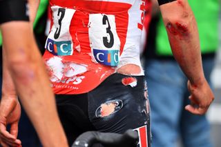 Image shows rider with road rash.