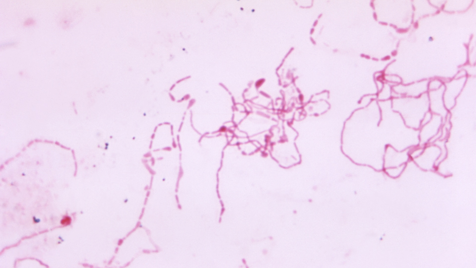 Photomicrograph of the rod-shaped bacterium Streptobacillus moniliformis, stained pink and magnified