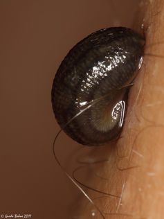 Leeches release a combinations of blood thinners and anaesthetics.