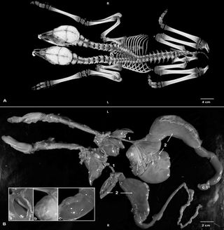 A CT scan of the fawns (A) revealed where their shared spinal column split into two individual necks and heads. A necropsy (B) showed twin sets of organs, including two hearts nestled in the same sac (a).