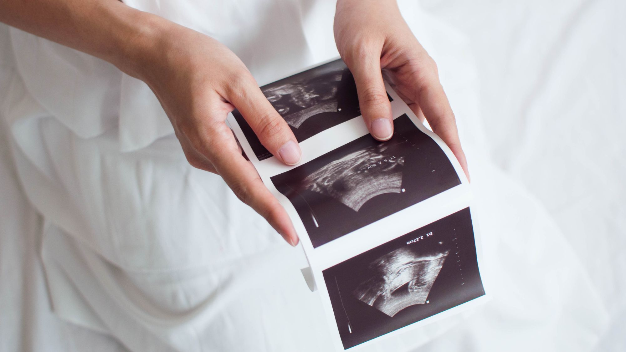 Woman holding baby scan via IVF