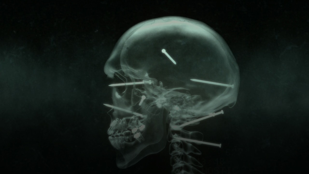 A frame from the opening credits of The Final Destination that shows an X-Ray view of nails embedded in a skull.