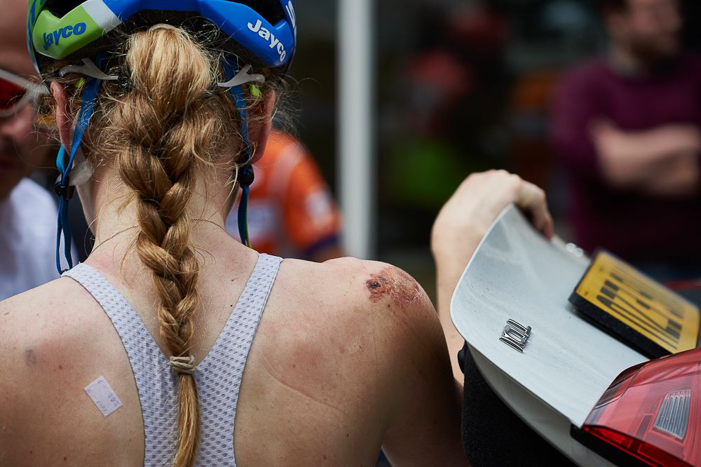 Battle scars