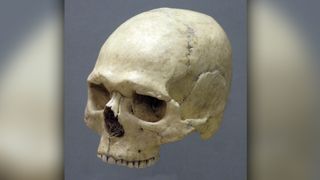 To get a replica of the Stone Age man's skull, forensic artist Oscar Nilsson put it in a CT scan. This gave Nilsson a virtual 3D image of the skull.