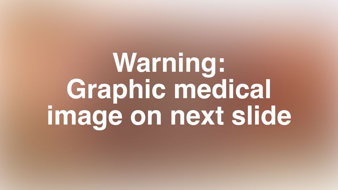 A slide that reads "warning: graphic medical image on next slide"