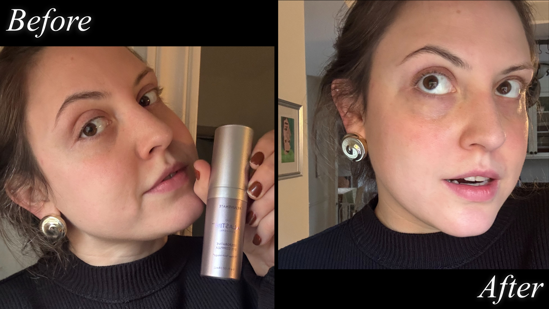 Contributing beauty writer Sophia Vilensky before and after testing Alastin&#039;s eye cream.