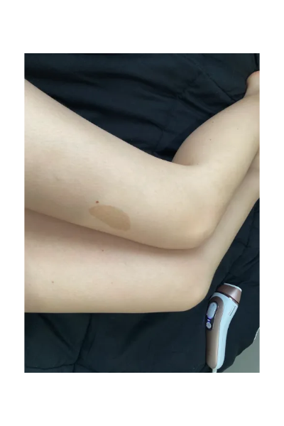 Breanna S., a ‘Marie Claire’ tester, tests the Braun Skin i·expert Smart IPL