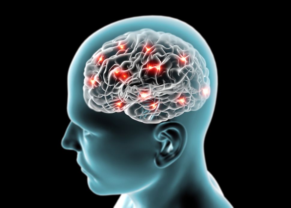 What Is Epilepsy?