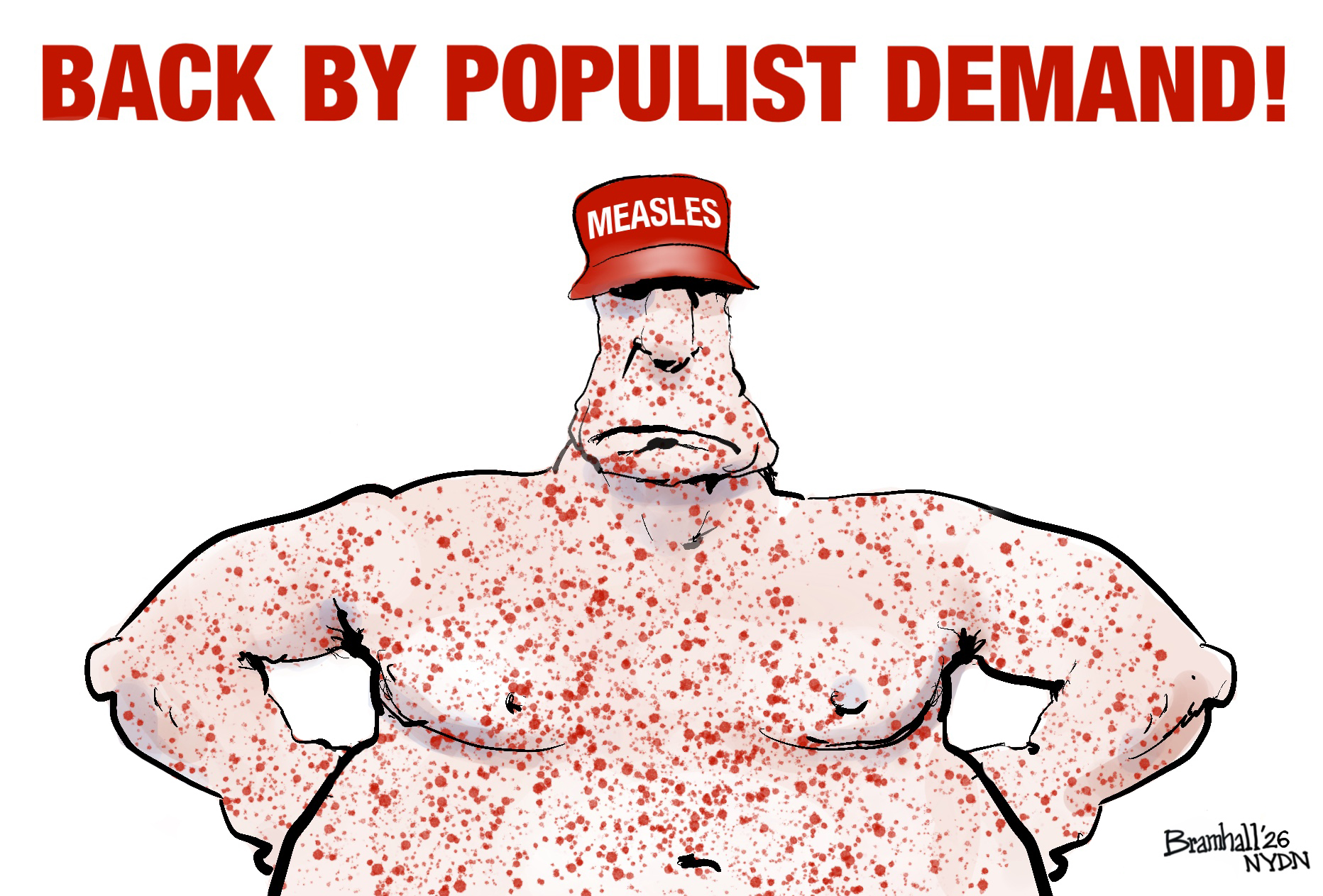 This cartoon is titled &amp;ldquo;Back By Popular Demand&amp;rdquo; and is dominated by the image of a heavyset, shirtless man covered in measles. He wears a MAGA-style hat that reads &amp;ldquo;MEASLES.&amp;rdquo;