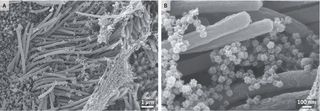 Images of SARS-CoV-2 captured with a scanning electron microscope. The SARS-CoV-2 virus particles appear as tiny, ball-looking structures. The noodle-like projections in the images are cilia, or hair-like structures on the surface of some airway cells.