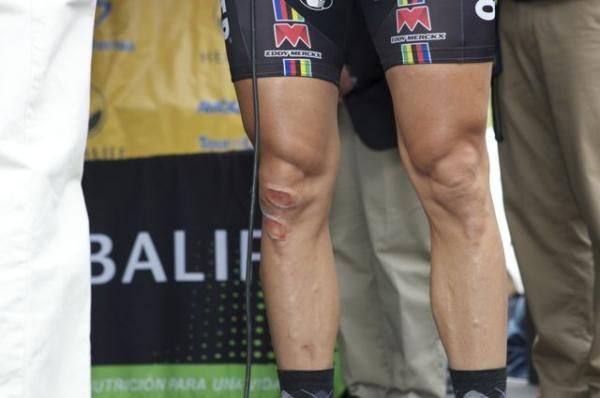 Scars on the legs of rider Tom Boonen (BMC)