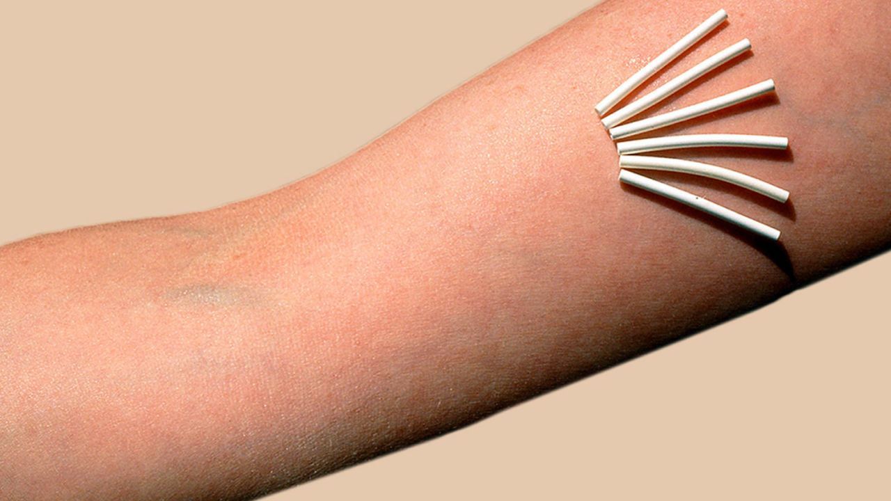 Arm, Skin, Joint, Hand, Finger, Tattoo, Wrist, Elbow, Human leg, Flesh,