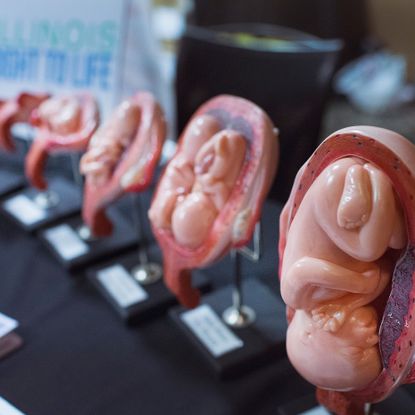 Rubbery fetus dolls in womb