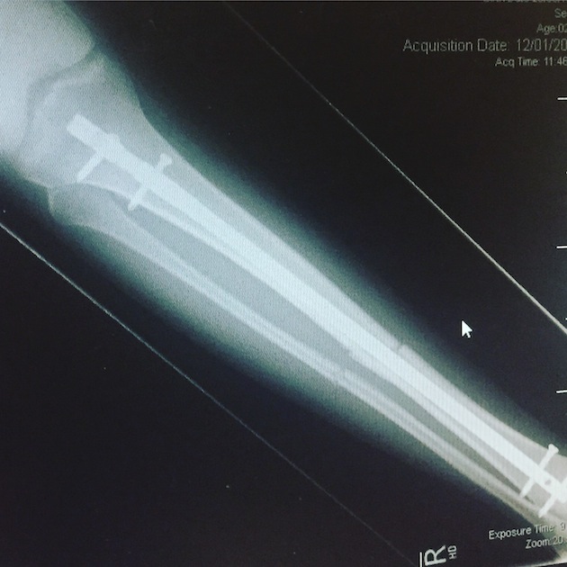 XRay1