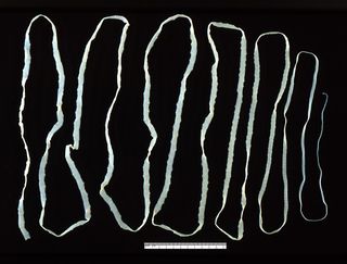 No microscope is needed for a close look at the tapeworm <em>Taenia saginata</em>, which regularly reaches 33 feet (10 meters) in length.