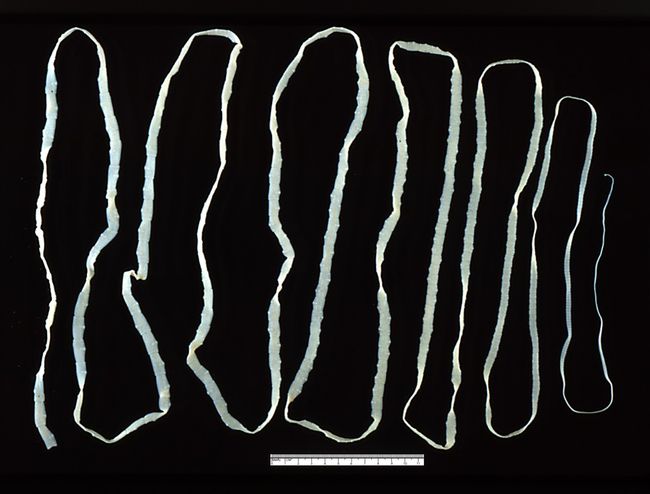 Taenia saginata редовно достига до 10 метра дължина.