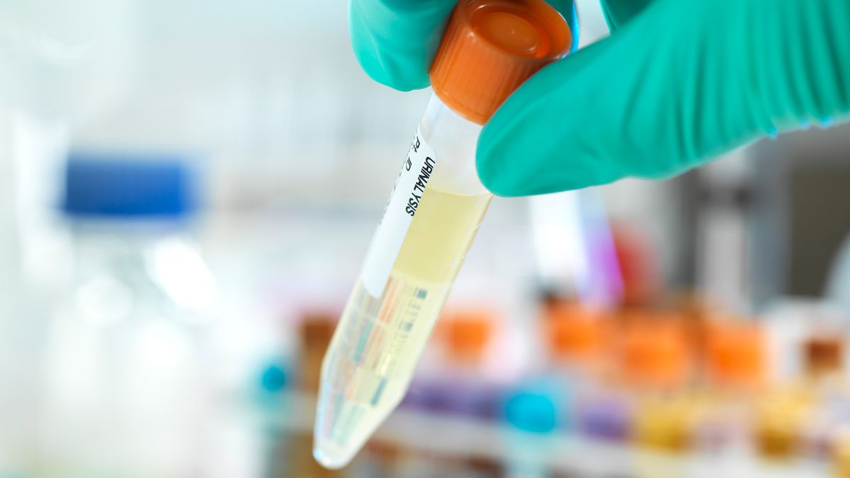 Technician holding a urine sample with other human medical samples in the background.