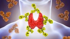 Illustration depicts a thyroid gland being attacked by antibodies 