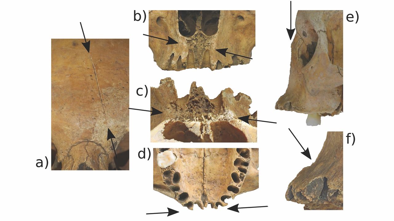 A close-up view of the trauma found on the teenager's skull. This includes (a) a cut mark by her nasal opening, (b) cut marks from the front of her nose, (c) from above, (d) by the jaw, (e) by the nose, and (f) a sharp nick on the right side of her skull.
