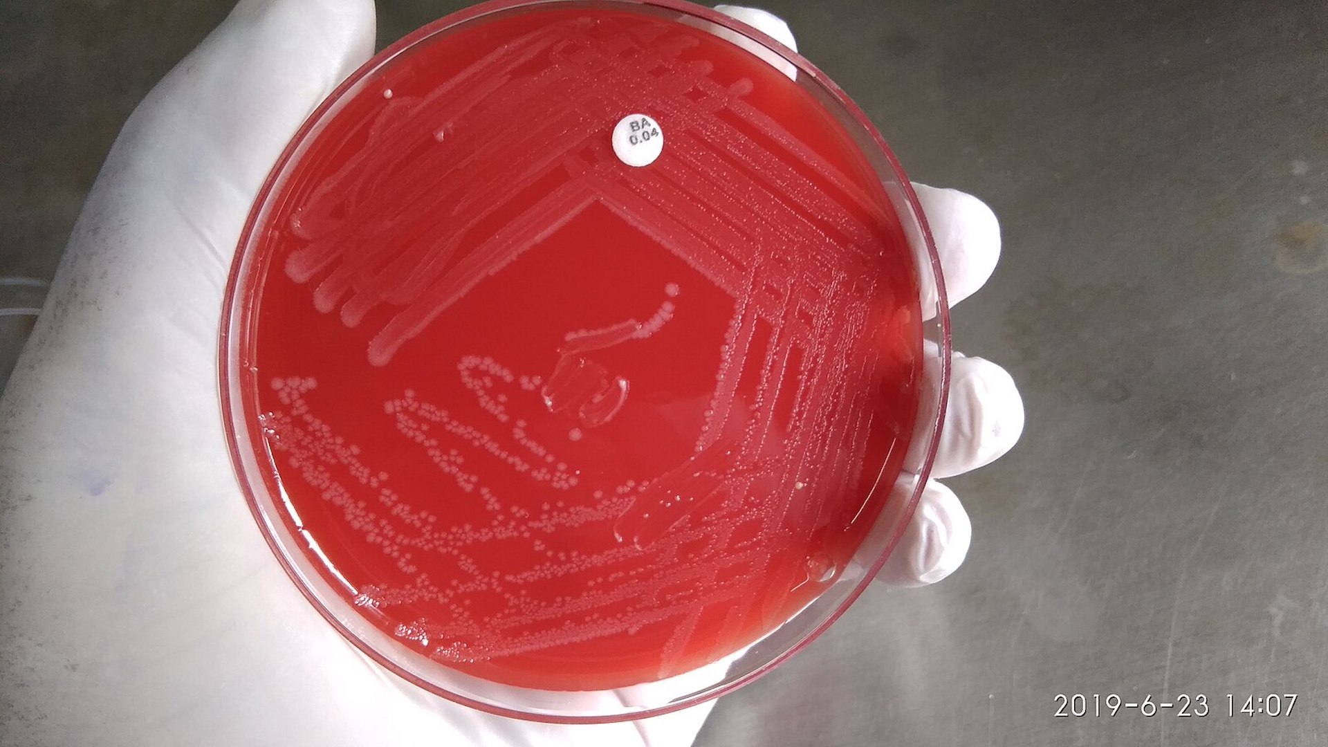 A gloved hand holds a circular petri dish with visible bacterial colonies