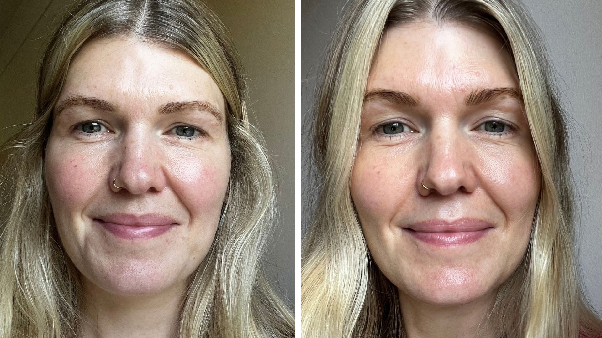 beauty editor Fiona McKim pictured before and after using Takami Soft Peel for 2 months, with smoother skin texture and a more even tone in the after pictures
