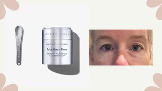 I tested Trinny London's eye cream on one eye, and the difference is unbelievable