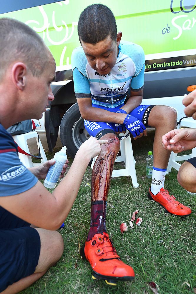 Rodrigo Contreras's knee was badly injured.
