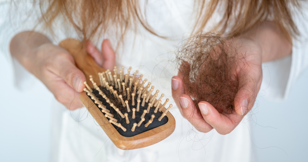 Hair Loss Cropped shot view of woman holding comb with hair loss after brushing her hair.