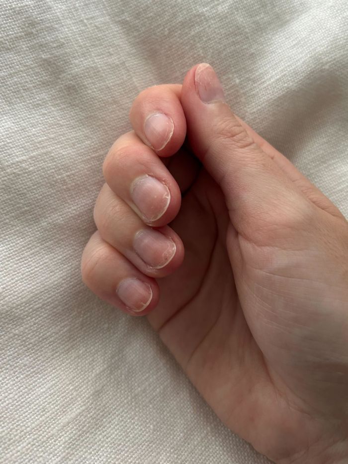 Junior beauty editor Grace Lindsay showing her nails before using the Manucurist Active Smooth nail polish