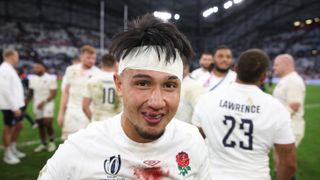 Marcus Smith of England looks on, as an inflamed lip and bloody bandages, before the England vs South Africa Rugby World Cup semi-final 2023. 