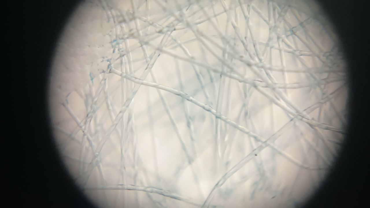 iMicro Q3p fingertip smartphone microscope
