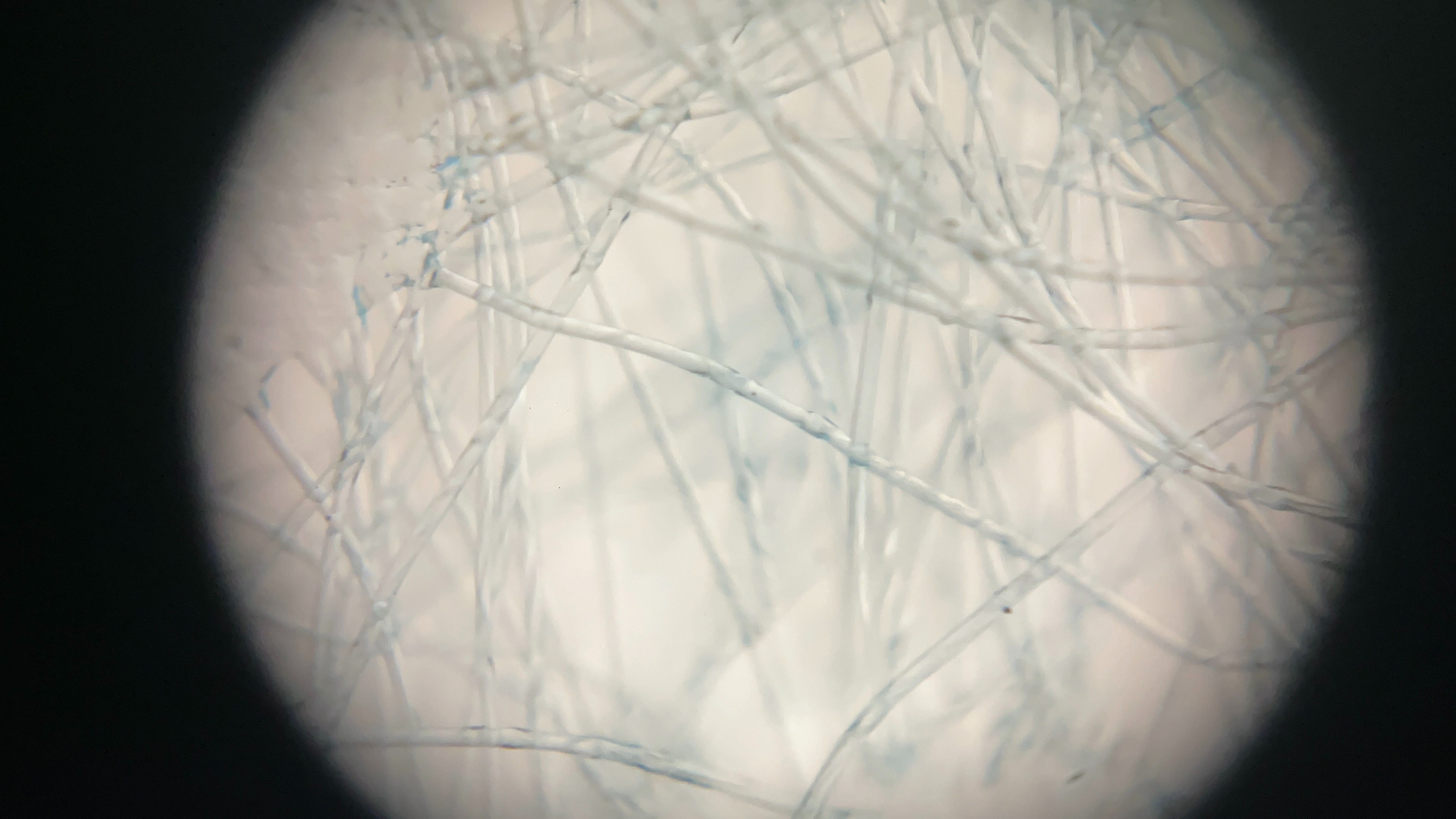 iMicro Q3p fingertip smartphone microscope