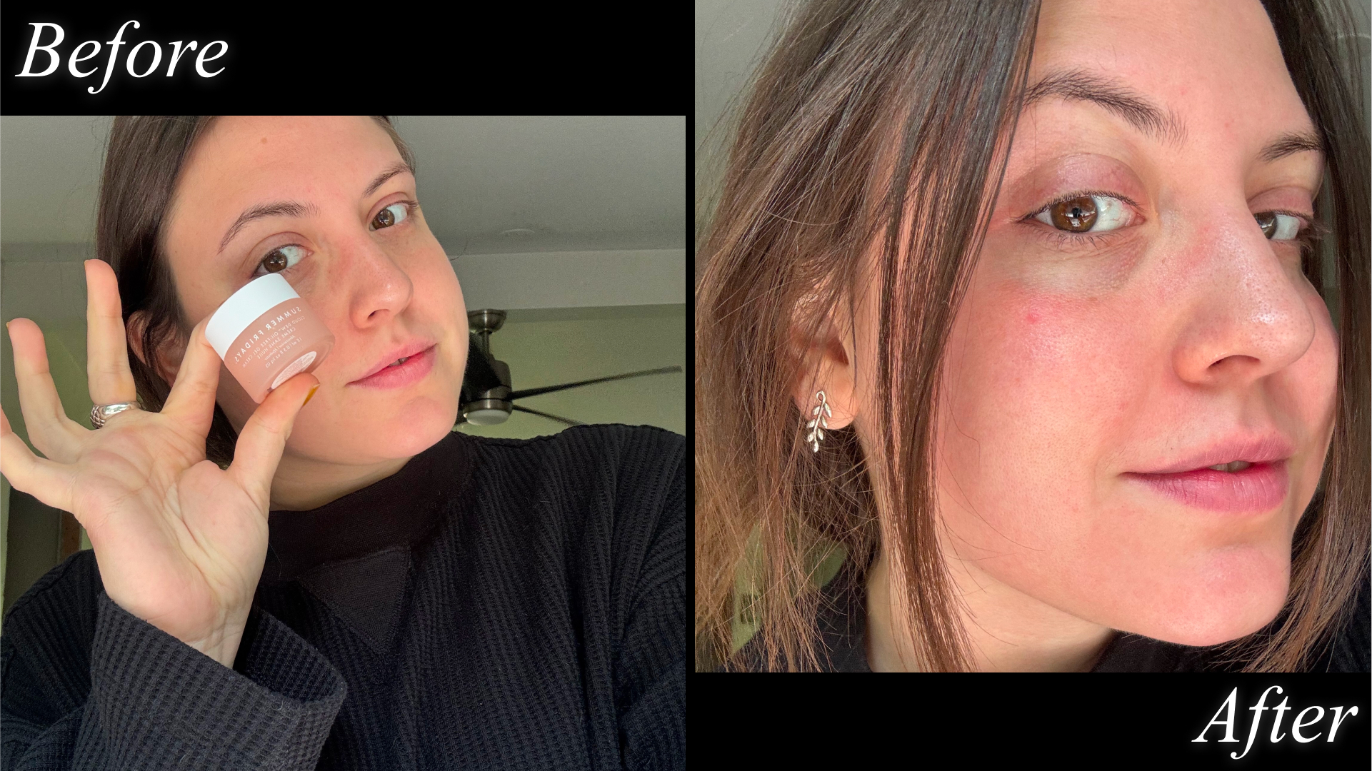 Sophia Vilensky before and after using summer fridays oil free moisturizer