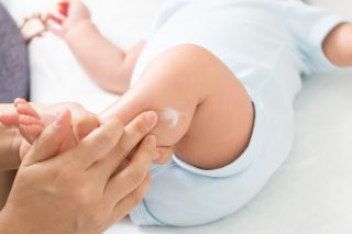 woman applying lotion to baby with eczema