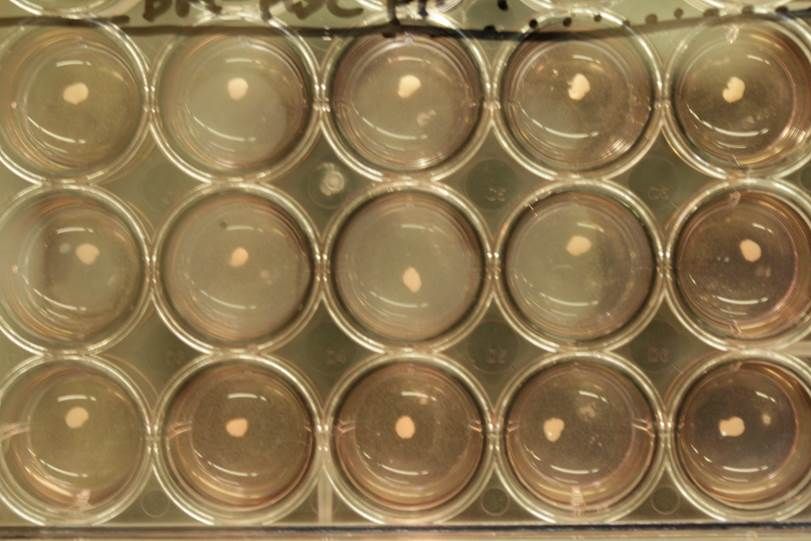 a number of lab dishes containing small liver buds.