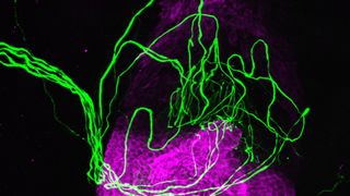 a bright green squiggle of nerves shown near a hair follicle, depicted as a dense, bright purple structure